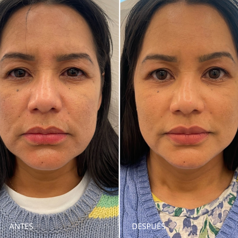 Skinbooster
