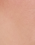 Eliminación de tatuajes